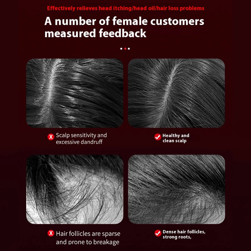 Electric Hair Scalp Massage