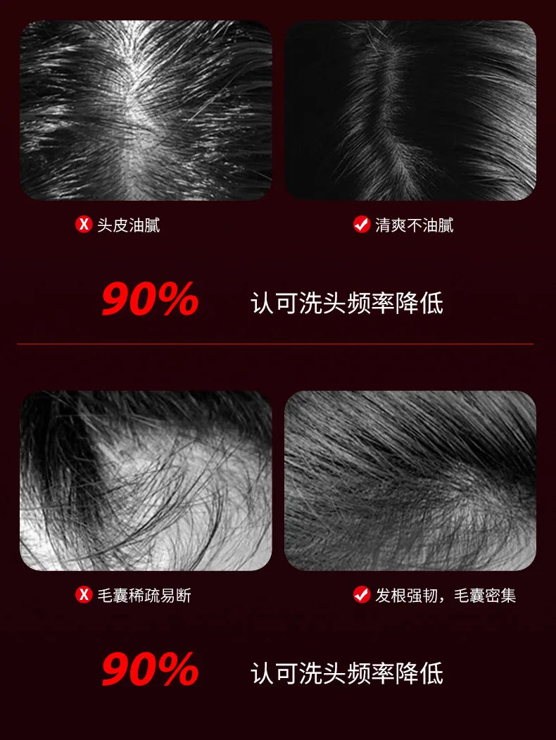 Electric Hair Scalp Massage