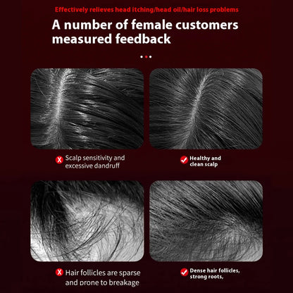 Electric Hair Scalp Massage