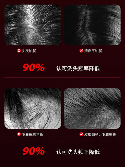 Electric Hair Scalp Massage
